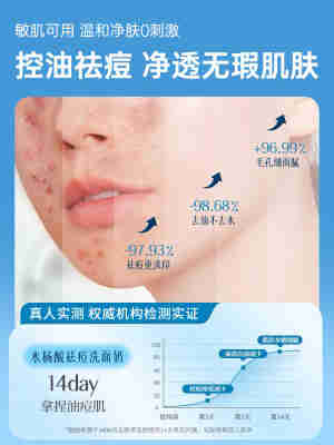 氨基酸洗面奶祛痘控油深层清洁收缩毛孔洁面女男士专用泡沫慕斯