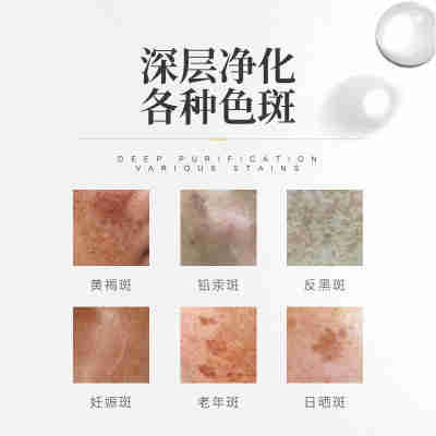 美容院提亮肤色断黑护肤品淡黄褐斑烟酰胺熊果苷炸斑王美白祛斑霜
